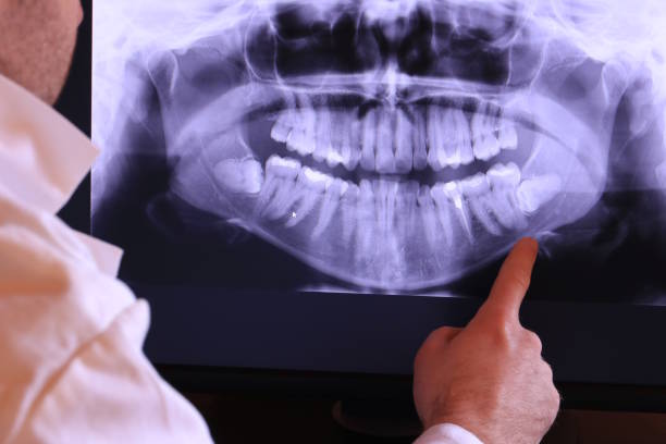 Best Emergency Denture Repair in Laurel, MT